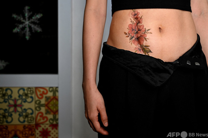 傷痕に咲いた花 女性たちを癒やすタトゥー ベトナム 写真18枚 国際ニュース Afpbb News