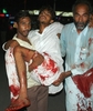 パキスタン・ラホール（Lahore）で、自爆攻撃に巻き込まれ病院に運ばれる負傷者（2010年9月1日撮影）。(c)AFP/STR
