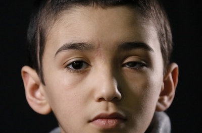 「未来が見えない…」 イスラエル軍に撃たれ失った目 パレスチナ