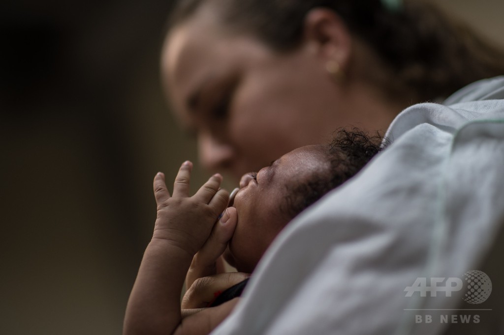 ブラジルの小頭症患者、508人に 1週間足らずで10%増 ブラジルの小頭症患者、508人に 1週間足らずで10%増