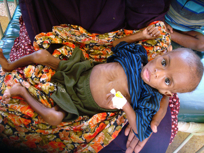 【写真特集】飢饉のソマリア、ケニアに大量流入する難民たち