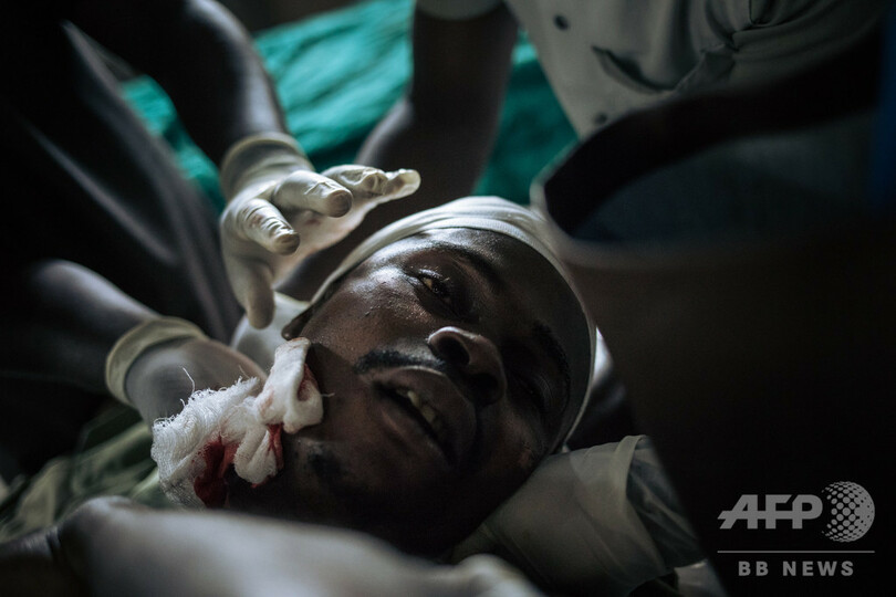 コンゴ武装勢力、半年で1300人殺害 国連発表