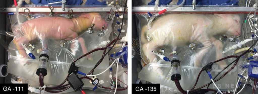 超未熟児向け人工子宮 ヒツジ胎児が正常発育 米研究 写真1枚 国際ニュース Afpbb News