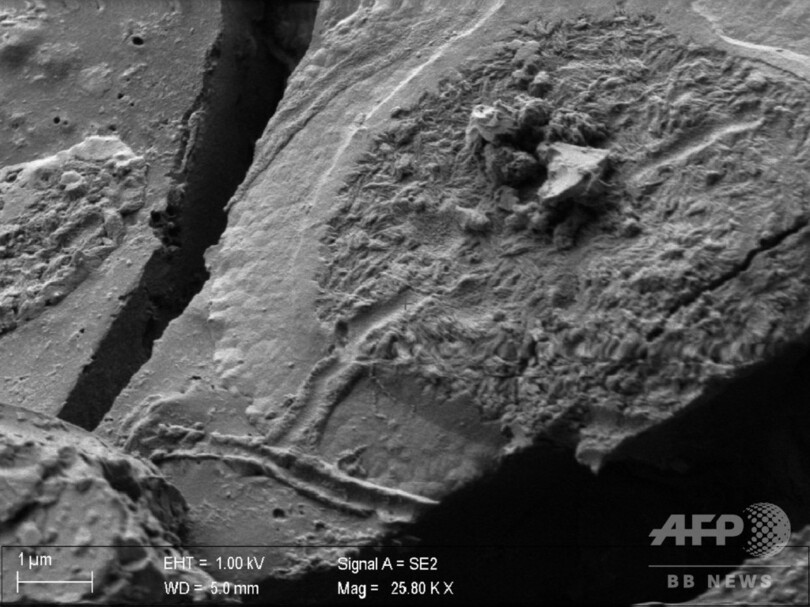 ベズビオ山噴火犠牲者から2000年前の脳細胞、保存状態は良好