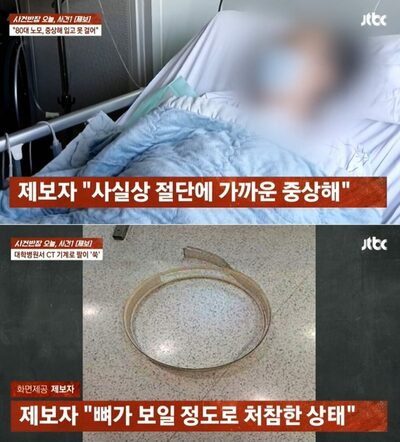 CT検査中に腕が“吸い込まれた”…韓国・80代女性、切断寸前の惨事と病院対応の行方