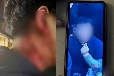 「飲酒運転」疑い、声をかけたら相手は組員…韓国・逆に襲撃され「命を落とす寸前」だった