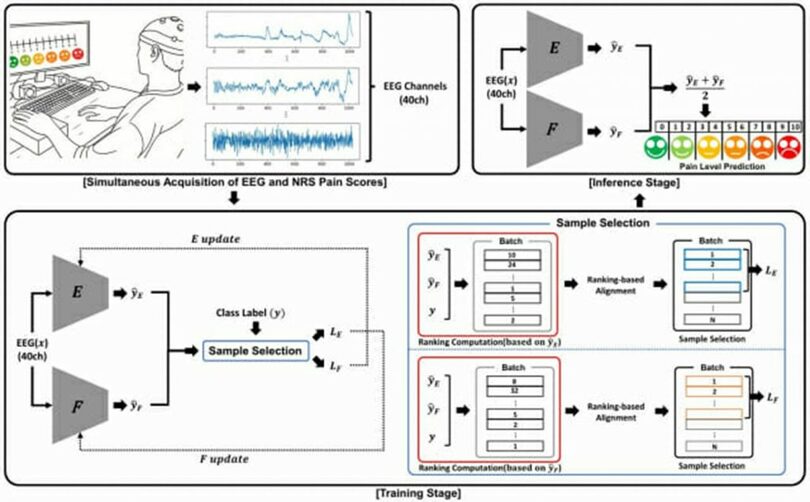 EEG基盤の痛み水準分類技法の全体過程＝DGIST(c)KOREA WAVE