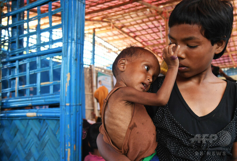 一難去ってまた一難 ロヒンギャ難民の子 栄養失調で死の淵に 写真13枚 国際ニュース Afpbb News