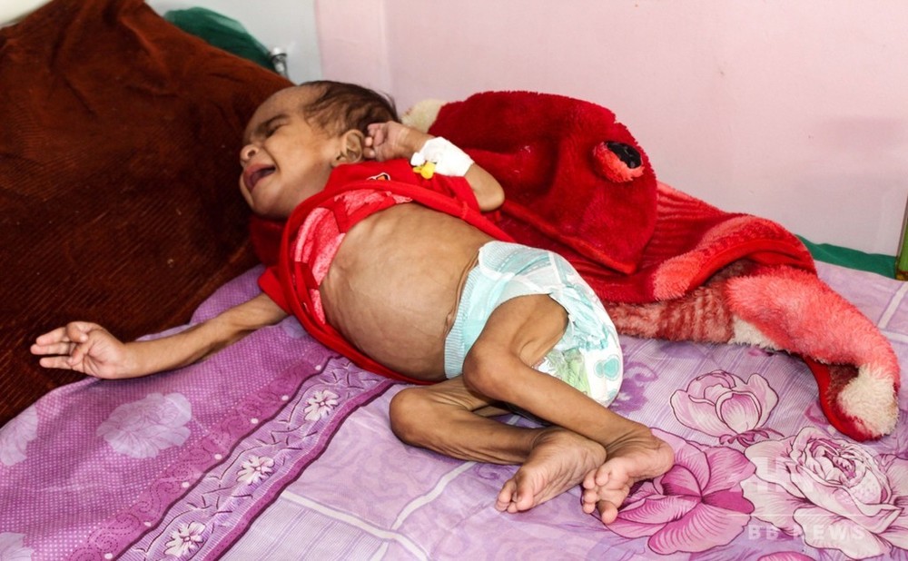 紛争で年間10万人超の幼児が死亡 国際ngo報告 写真5枚 国際ニュース Afpbb News