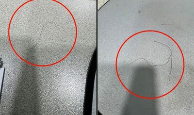 韓国・職場で体毛まく嫌がらせ…50代男性の行為に波紋