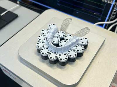 見えない「矯正力」を可視化…韓国発・次世代の歯科センサー