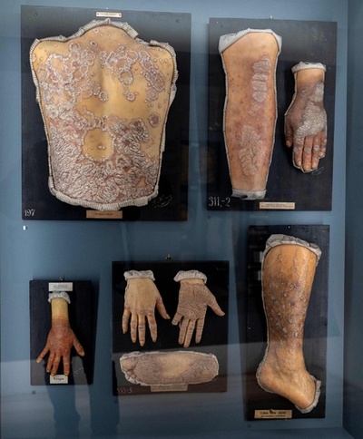 人体標本の展示、倫理と公共利益の間で ウィーン博物館