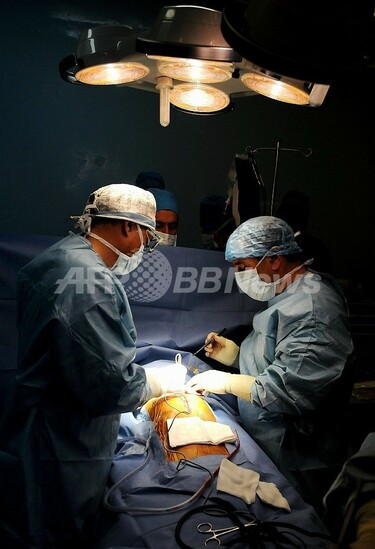 男性の体内から42キロの腫瘍を摘出、バングラデシュ 写真1枚 国際