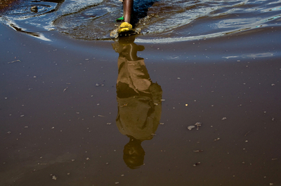 情勢悪化のコンゴ（旧ザイール）東部、コレラもまん延