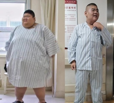 1年で200キロの減量に成功！ 山東省の20歳男性