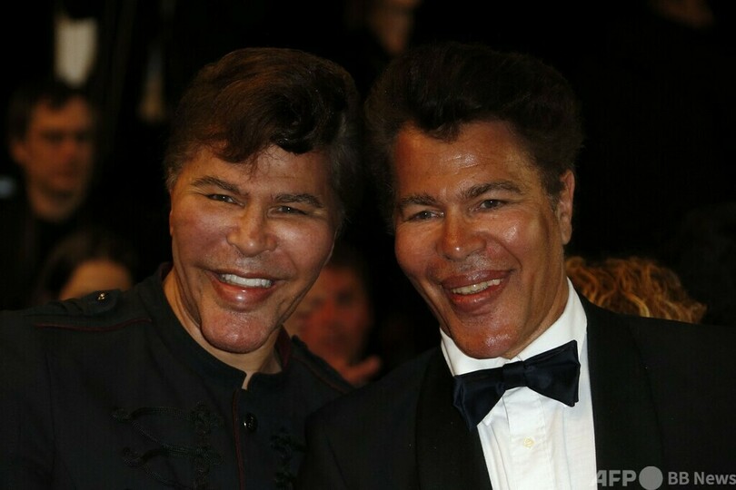 仏有名双子タレントのボグダノフ兄弟、コロナで相次ぎ死去 72歳