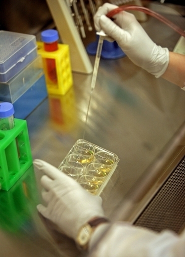 マウスの皮膚細胞から神経細胞を直接作製、iPS細胞使わず 米スタンフォード大