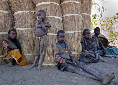 ウガンダの子供たちを襲う謎の奇病「うなずき病」、原因も治療法も不明