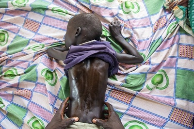 南スーダン、「人災」による飢饉で600万人の生命が危機に 