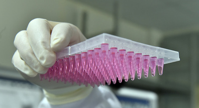 「自閉症」サル、遺伝子操作で作製 中国チーム