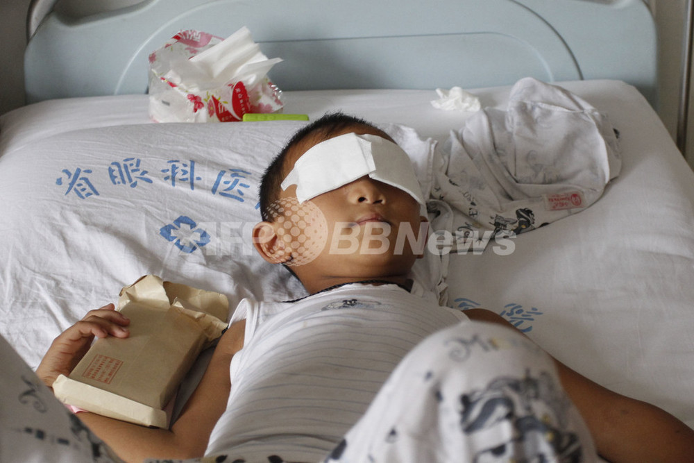 両目くりぬかれた男児に義眼装着へ最初の手術 中国 写真1枚 国際ニュース Afpbb News