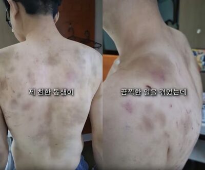 「逃げたら家族を殺す」韓国の中華料理店で“現代版奴隷”発覚…ハンマーや鉄棒で部下を痛ぶった店主の異常ぶり