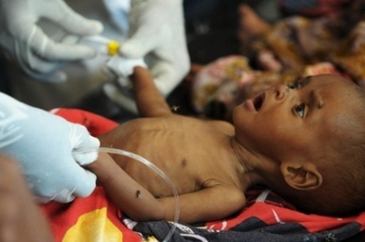 肥満人口が栄養不足人口を上回る、赤十字社2011年報告書