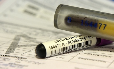 WADA会長、ロシアの新たな疑惑受け遺憾の意