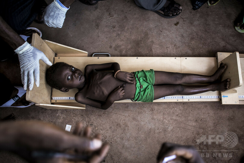 コンゴで子ども40万人以上が餓死する恐れ 栄養失調深刻 ユニセフ 写真2枚 国際ニュース Afpbb News