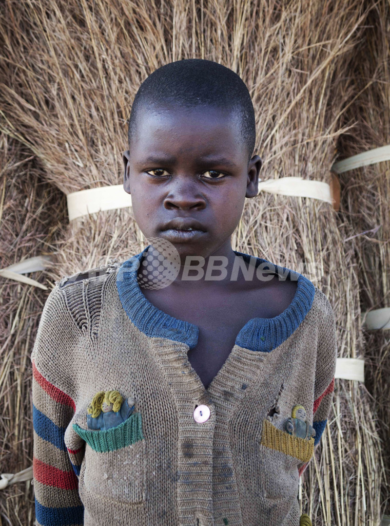 ウガンダの子供たちを襲う謎の奇病「うなずき病」、原因も治療法も不明