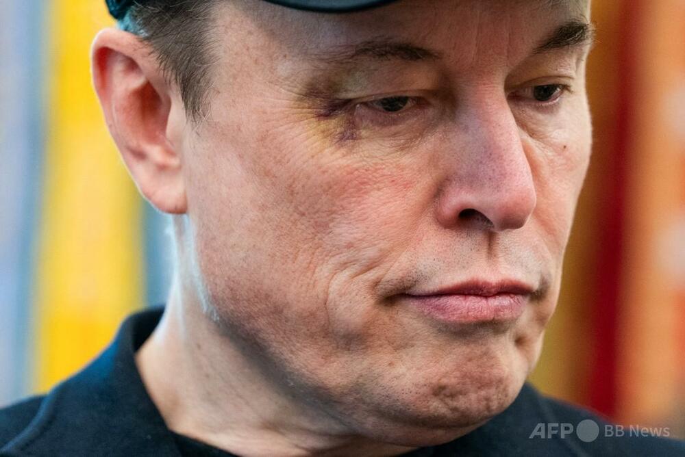 マスク氏、トランプ氏の「友人であり続けたい」目の周りにあざの奇妙な別れ　写真3枚　国際ニュース：AFPBB News
