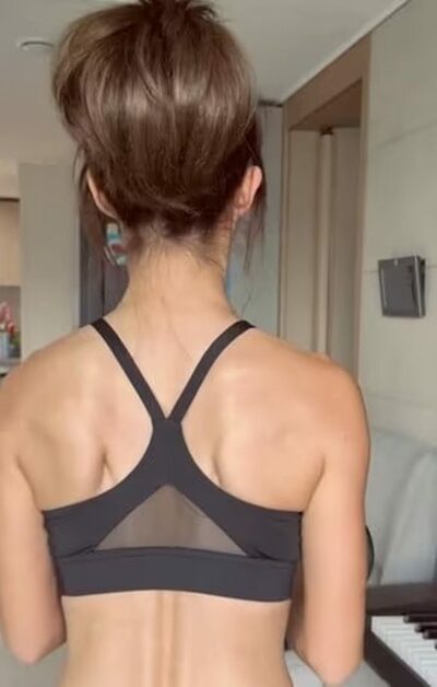 韓国タレント俳優が相次ぎ「白斑」告白…完治困難、強い外見的ストレス