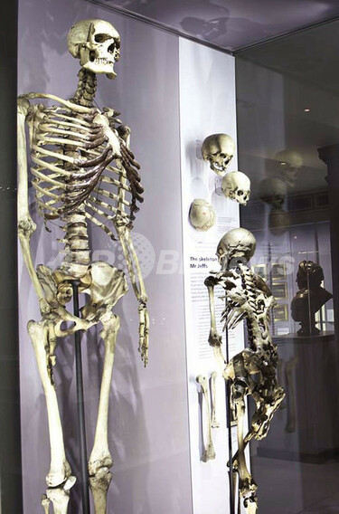 アイルランドの巨人」に安らかな眠りを、英医学者が主張 写真2枚 国際