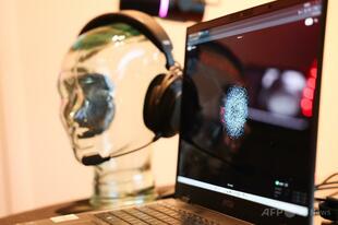 AIとウェアラブルデバイスで早期発見 自己チェックが身近に