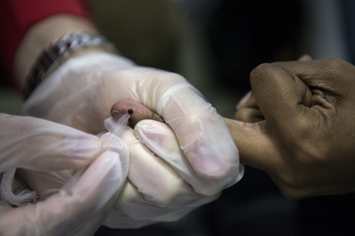 スマートフォンでHIVと梅毒を検査、新技術開発 米研究