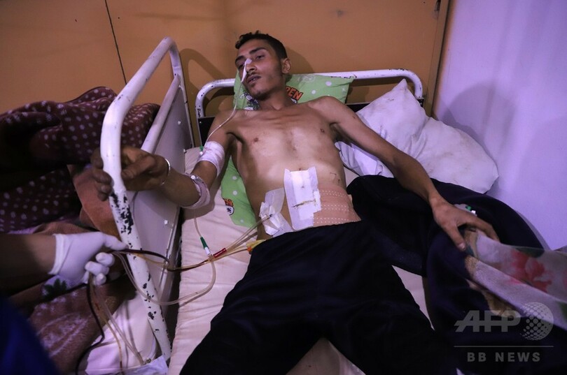 シリア政権軍、東グータで化学兵器使用か 幼児1人窒息死