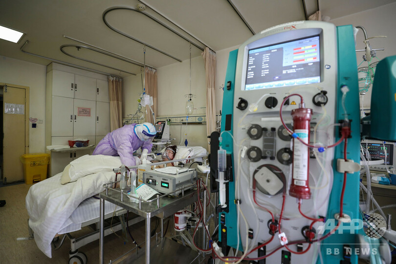 「人工呼吸器の確保を」 WHOが各国に呼び掛け 新型ウイルス重症者への備え