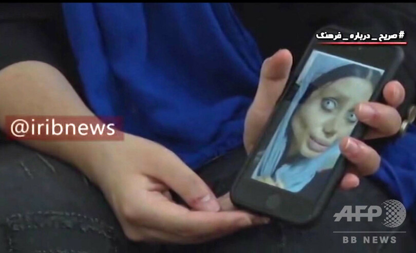 美容整形で「ゾンビ」顔に…有名インスタグラマーが後悔語る イラン