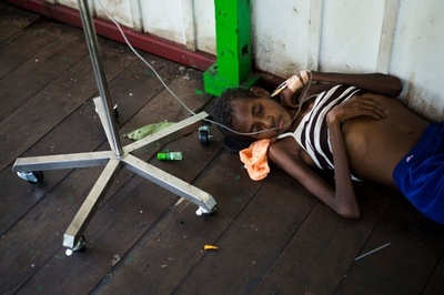 子ども800人が麻疹や栄養失調、100人死亡か インドネシア・パプア州