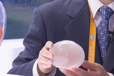 中国輸入博で「ブラックテクノロジー」大活躍 食欲抑制効果のある胃内バルーン製品登場