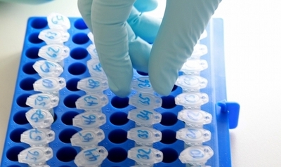 大腸菌、感染源はエジプト産香辛料か 欧州食品安全機関