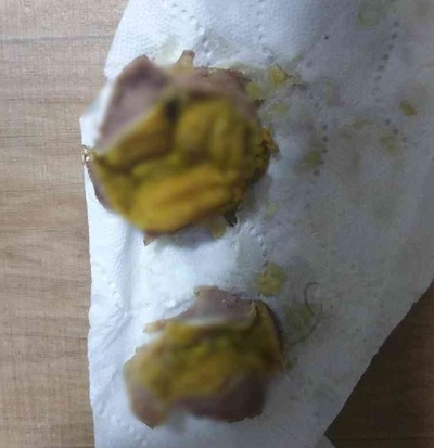 一口噛んでわかった「これは汚物の味」…韓国チキン店の砂肝に「黄色い物体」、回収