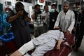 パキスタンのカイバル・パクトゥンクワ州の自爆攻撃で負傷した人（2023年7月30日撮影）。(c)Abdul Majeed AFP photographer / AFP