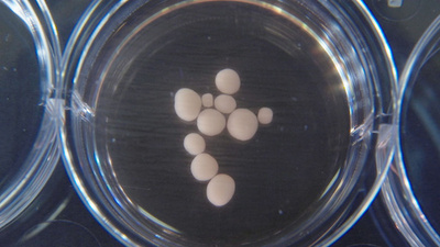 実験室で培養の「ミニ脳」に神経活動、人の脳に類似 米研究