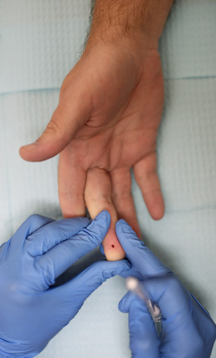 自殺傾向の血液検査に前進、関連遺伝子を特定 米研究