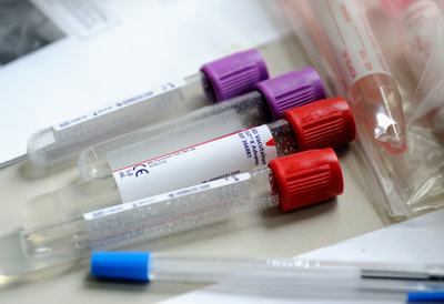 レジオネラ症で7人死亡、感染者86人 米ニューヨーク