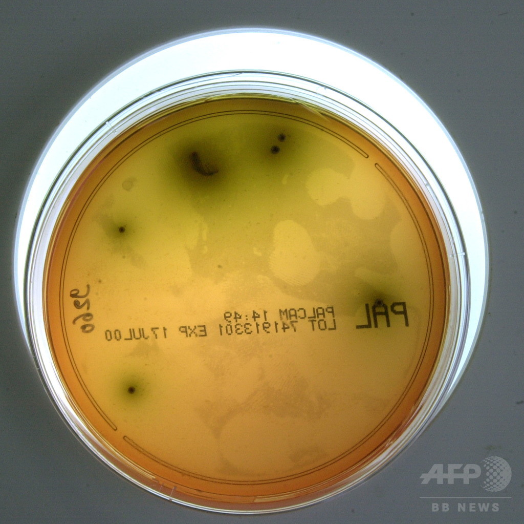 南アフリカのリステリア感染、死者200人以上に 史上最悪の被害 南アフリカのリステリア感染、死者200人以上に 史上最悪の被害