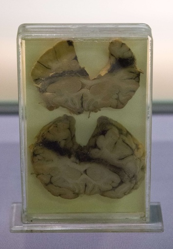 生々しい犯罪の痕、科学捜査の核心に迫る展覧会 英ロンドン