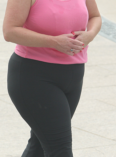 肥満関連のがん、米国の若い世代で急増 大規模調査で判明