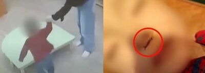 韓国・保育園、うちの子ども「遊んでいてけが」…職員の様子に違和感、調べたら「虐待」だった